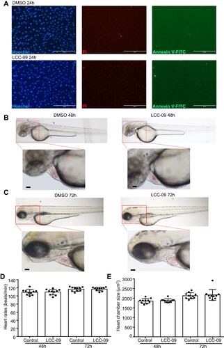 Figure 5 LCC-09 does not induce toxicity in cultured endothelial cells or zebrafish embryos. (A) HUVECs were cultured with LCC (10 μM) or DMSO control for 24 h and then stained with Hoechst, PI and annexin V-FITC. Images are representative of 3 independent experiments. (B–E) Zebrafish embryos at 6 hpf were incubated with LCC-09 (10 μM) or DMSO as control for 48 and 72 h, respectively. Heart rates and chamber sizes were measured and compared. Scale bar: 200 μM (A), 50 μM (B and C).
