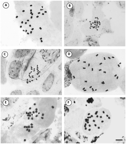 Figure 1. Photomicrographs of mitotic metaphases in Solanum species of Morelloid clade with 2n = 24. (A) S. echegarayi; (B) S. palitans; (C) S. pilcomayense 2279; (D) S. pilcomayense 2287; (E) S. reductum; (F) S. sarrachoides. Scale bar = 6 μm, all photomicrographs at the same scale. Arrows indicate satellites.