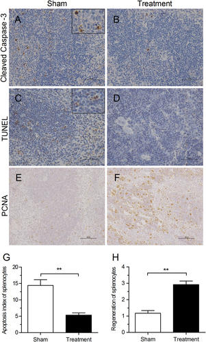Fig. 6 C5a–C5aR blockade in hDPP4-transgenic mice increases splenic cell regeneration and decreases splenic cell apoptosis.a, b Apoptosis of splenic cells was assessed by immunohistochemical staining of cleaved caspase-3 in spleen tissues 7 days after challenge. c, d Apoptosis of splenic cells was detected using a DAB TUNEL-based apoptosis detection assay in spleen tissue 7 days after challenge. e, f Representative images of regenerated splenic cells detected by IHC staining of PCNA 7 days after challenge. g Apoptosis index of splenocytes was assessed according to TUNEL-based apoptosis detection in spleen sections 7 days after challenge. h Semi-quantitative analysis of PCNA-positive cells in spleen sections 7 days after challenge (n = 5 per group)