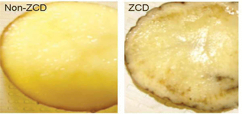 Fig. 1. Cross-sections of potato tubers used in this study. Healthy (non-ZCD) and exhibiting zebra chip disease symptoms (ZCD). Zebra chip diseased tubers were subsequently all confirmed to be PCR-positive for ‘Candidatus Liberibacter solanacearum’.
