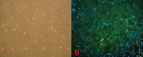 Figure 1.  Morphological observation and immunofluorescence of cardiomyocytes. (A) Primary cultures of neonatal rat cardiomyocytes at 36 h (100×). (B) Sarcomeric actin protein was revealed by immunofluorescence using a mouse polyclonal antibody to Sarcomeric actin (green fluorescence; 200×).