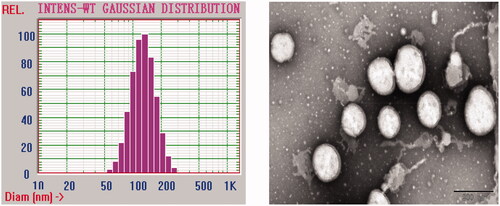 Figure 1. The particle size distribution diagram and transmission electron microscopy of BBR-10-HCPT loaded LM.