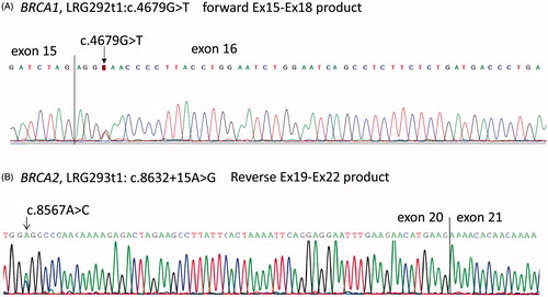 Figure 1. Allele specific mRNA splicing assays. (A) Direct Sanger sequencing electropherogram of RNA from a BRCA1, LRG292t1: c.4679G > T carrier showing equal representation of wildtype and variant alleles and no cryptic splicing in the RT-PCR products generated with primers located in exon 15 and 18. Albeit, the variant does not affect splicing, it is a missense variant and the effect on protein function has not been established. Hence it is still classified as C3. (B) Direct Sanger sequencing electropherogram of RNA from a BRCA2: LRG293t1: c.8633 + 15A > G carrier showing equal representation of wildtype and variant alleles as evident from exonic variant c.8567A > C in the RT-PCR products generated with primers located in exon 19 and 22. Furthermore, no cryptic splicing is observed at the exon 20–21 junction. Based on this c.8633 + 15A > G is classified as C2.