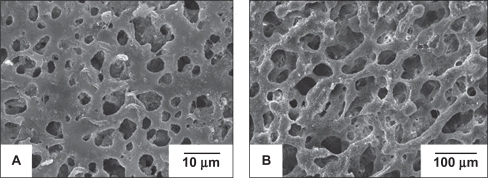 Figure 1 SEM photos of nHA/PA66 membrane: micropore surface (A) and spongy surface (B).