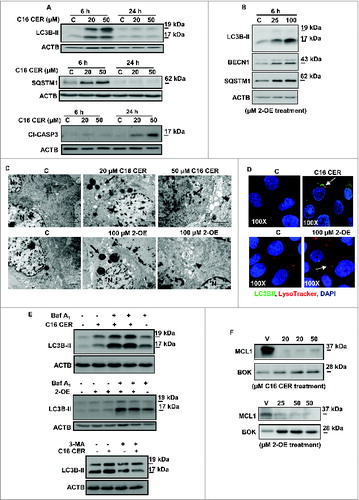 Figure 7. Ceramide triggers autophagy in JEG3 cells. (A) LC3B-II, SQSTM1 and cleaved CASP3 (Cl−CASP3) protein expression in JEG3 cells treated with C16 CER or vehicle (C). (B) Autophagy markers, LC3B-II, BECN1, and SQSTM1, in JEG3 cells cultured with ASAH1 inhibitor 2-OE (25 μM or 100 μM) or control vehicle (C). (C) Representative transmission electron micrographs of JEG3 cells treated with C16 CER or 100 μM 2-OE compared to control vehicle. Autophagy is shown by increased number of lysosomes (arrows) and formation of autophagosomal structures (arrowheads). N, nucleus. Scale bars: 2 μm. (D) JEG3 cells treated with C16 CER or 2-OE were labeled with LysoTracker® Red and stained for LC3B. LC3B (green), LysoTracker® Red and nuclear DAPI (blue). (E) LC3B-II expression in JEG3 cells treated with C16 CER (upper panel) or 2-OE (middle panel) in the presence and absence of bafilomycin A1 (Baf A1) or of 3-methyladenine (3-MA; lower panel). (F) MCL1 and BOK expression in JEG3 cells treated with 20 μM or 50 μM C16 CER (upper panel) or 25 or 50 μM 2-OE (lower panel).