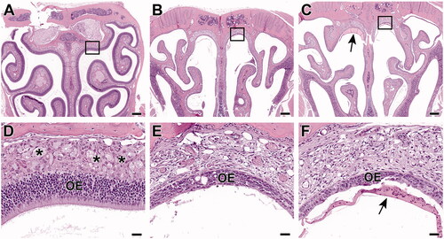 Figure 5. Level III sections of the nose from B6C3F1/N mice exposed to 2-ethyltoluene via whole-body inhalation for 2 weeks. In the control female mouse (A, D), a uniformly thick olfactory epithelium (OE) lines all surfaces. In a higher magnification section at the dorsal meatus (area within the box), the olfactory nerves (*) are prominent in the lamina propria underlying the OE. In female mice from 150 ppm (B, E) and 300 ppm (C, F), there is marked atrophy of the both the olfactory epithelium (OE) and of the olfactory nerves (*). The olfactory nerves are readily observable in the control animal (see asterisks in D), but they are inapparent in the animals from 150 ppm (E) and 300 ppm (F). There is also inflammatory exudate present (arrow). (A, B, C: 4× original magnification, scale bar = 250 µm. D, E, F: 40× original magnification, scale bar = 25 µm). H&E.