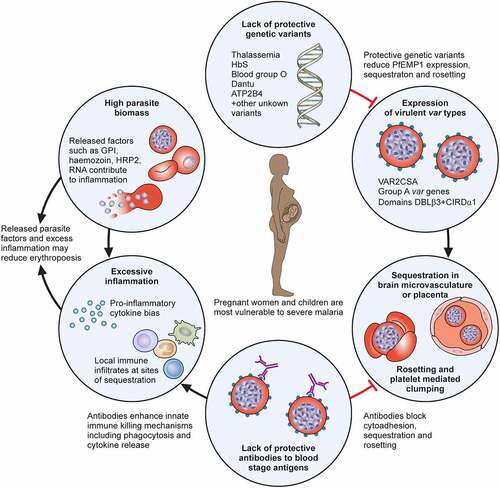 Figure 1. Key pathogenic factors that contribute to severe malaria. High parasite biomass and parasite products released into circulation during cell lysis are stimulants for inflammation and may directly contribute to severe anaemia by reducing erythropoiesis. A strong inflammatory response, including Th1 type cytokine bias and sequestration of innate immune cells, such as monocytes, can activate and damage endothelial cells, enhance sequestration and contribute to severe anaemia by excessive complement mediated lysis of uninfected erythrocytes. A lack of antibodies targeting IE surface antigens may contribute to high parasite biomass and sequestration, although the key targets of antibodies are unclear. Sequestration of IE, mediated by PfEMP1, allows the parasite to evade clearance by the spleen and sequestration in the brain of young children is key to the pathogenesis of cerebral malaria. Sequestration in the placenta is strongly associated with poor pregnancy outcomes. Sequestration in the placenta is mediated by PfEMP1 expressed from VAR2CSA and sequestration in the brain microvasculature is associated with Group A PfEMP1 with domains that bind to ICAM-1 and EPCR. Protective genetic variants can reduce PfEMP1 expression, sequestration and rosetting.