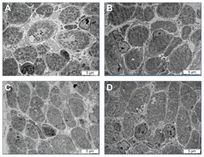 Figure 4 Images of the ultrastructure of the cross-section of the breast muscle of a chicken embryo on day 20 of incubation visualized using transmission electron microscopy. (A) Control, (B) gold nanoparticles, (C) heparan sulfate, and (D) gold nanoparticles and heparan sulfate complex.