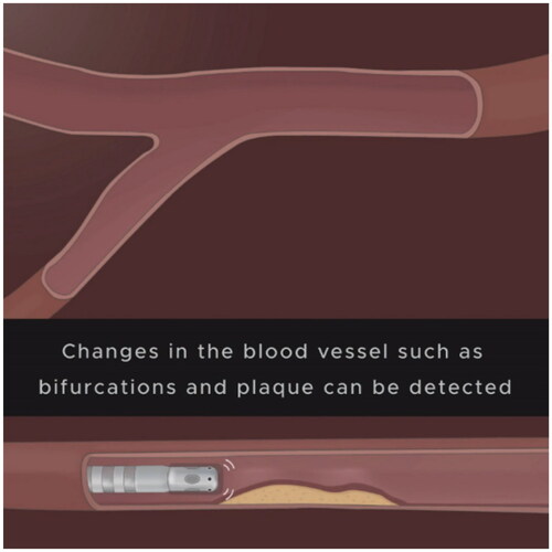 Figure 13. Still from the weakly electric fish and biomimicry – long animation.