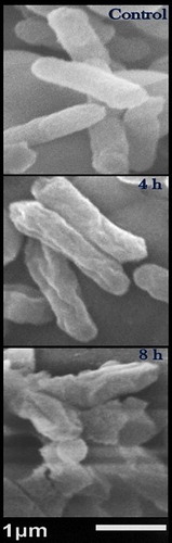 Figure 3. Scanning micrographs of resistant Salmonella Typhimurium treated with silver/fungal chitosan nanocomposite for 4 h and 8 h, compared with control (non-treated) cells.Note: The examined Ag/FC-NPs concentration was 5 µg/mL