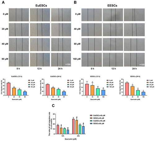 Figure 4 Quercetin inhibits the migration of EuESCs and EESCs in vitro. (A) EuESCs were exposed to increasing concentrations of quercetin (0, 20, 40, and 80 μM) for 72 h prior to the experiment. Representative images for cell scratch assay on EuESCs under a microscopy (Magnification ×100) at 0, 12 and 24 h. The bar graphs represented the cell migration rate of EuESCs. (B) EESCs were exposed to increasing concentrations of quercetin (0, 40, 80, and 160 μM) for 72 h prior to the experiment. Representative images for cell scratch assay on EESCs under a microscopy (Magnification ×100) at 0, 12 and 24 h. The bar graphs represented the cell migration rate of EESCs. (C) The bar graph represented the ratio of cell migration rate between quercetin treatment group (40 or 80 μM) and control group (0 μM). Data were presented as mean ± SD; *P <0.05 vs 0 μM group; #P <0.05 vs EuESCs group. Each experiment was performed three times.