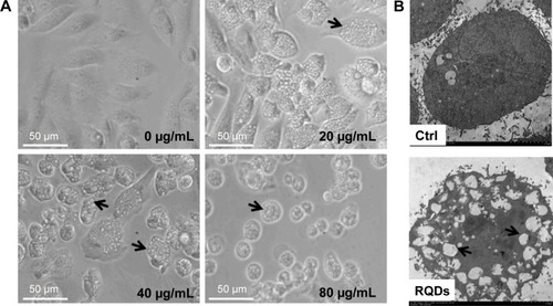 Figure 4 Morphological change of JEC cells treated with RQDs.Notes: (A) Vacuolization induced by RQDs, with the arrows indicating the vacuolization and ER dilation. (B) Ultrastructural analysis of JEC cells by ultrathin section transmission electron microscopy.Abbreviations: Ctrl, control; RQDs, realgar quantum dots.