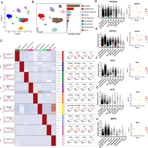 Figure 5 Identification of Cell Subtypes in Single-Cell Dataset. (A) Shared Nearest Neighbor (SNN) modularized optimized clustering algorithm divides cells into 14 subgroups, with the UMAP plot illustrating the clustering of different cell types. (B) The 14 subgroups are annotated as 9 cell types. (C) Expression levels of marker genes in different subgroups. (D-H) Expression levels of shared diagnostic genes in different cell subtypes.
