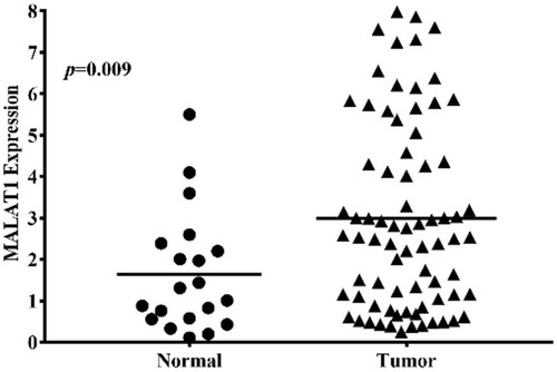 Figure 1 The expression of MALAT1 in normal and tumor tissues in breast cancer patients. Total RNA was extracted from tumor and para-tumor samples of all breast cancer patients. The RNA was reversely transcribed into cDNA, as template to amplify MALAT1 by quantitative real-time PCR.