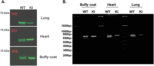 Figure 2. Analysis of Syk isoforms in multiple tissues of Syk S291A knock-in mouse: A) Cellular extracts from different tissues from Syk S291A mice (as indicated) and wild-type littermates were run on 8% SDS-PAGE and analyzed by western blot using total Syk antibody. Two isoforms are seen in wild-type tissue extracts but only long form of Syk is seen in the tissue extracts from the Syk S291A knock in mice. B) RNA was isolated from different tissues from Syk S291A mice and wild-type litter mates was analyzed by RTPCR. The primers used were 5’-CTGAAGGAGAACCTCATCAGGG-3’ (corresponding to 841–863) as sense primer and 5’- GGCTCCTGTCCAGGTAGACC-3’ (corresponding to 1463–1442) as the antisense primer.