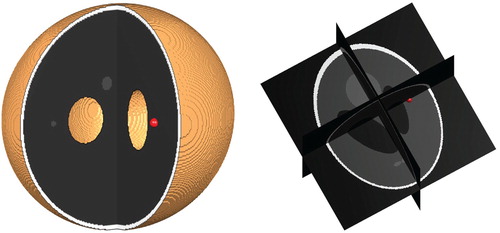 Figure 4. Position of the initial tumour cell density in the 3d Shepp–Logan image and its corresponding 3d planes.