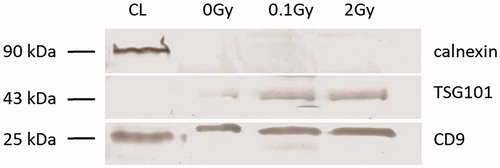 Figure 2. Western blot analysis of plasma-derived extracellular vesicles extracellular vesicles were isolated with Exiqon’s miRCURY Exosome Isolation Kit – Serum and Plasma and western blot analysis of extracellular vesicles for calnexin, TSG101 and CD9 was performed as detailed in the Materials and methods section. The blot shows, whole cell lysate (lane 1), plasma extracellular vesicles isolated from sham irradiated mice (lane 2), total-body irradiated mice with 0.1 Gy (lane 3) and 2 Gy (lane 4). The sizes (in kD) of the investigated proteins are shown on the right.