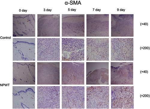 Figure 3 Immunohistochemistry (40×magnification or 200×magnification) for the expression of α-SMA representing freshly formed blood vessels at day 0, 3, 5, 7, and 9 postwounding.