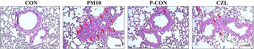 Figure 1. Effects of CZL extract treatment on histological change in PM10-treated mice lung tissue. Representative histological sections of lung tissue processed through H&E staining. Red arrows point to inflammatory cell infiltration. Scale bars of 100 μm represent the magnification of 200×.