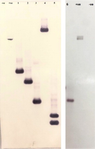 Figure 2. Southern blot analysis of transgenic plants (Lanes: –ve: DNA from Wild type plant; +ve: DNA from pCAMBIA1301-OsRuvB; 1–6: DNA from transgenic lines where 1: L-66, 2: L-37, 3: L-32, 4: L-17, 5: L-107, 6: L-10). Full length blots are displayed in supplementary figure 2. Different blots separated by white spacing in between.