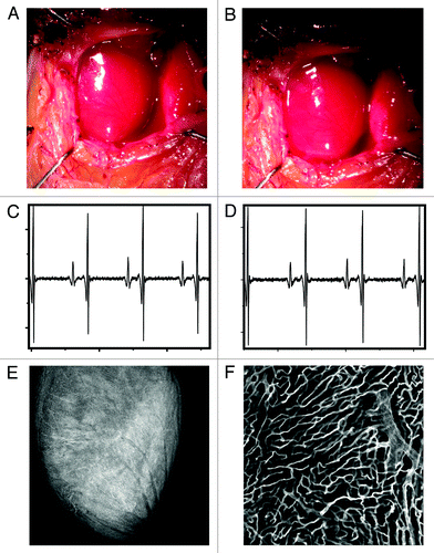 Figure 5. White light image of the heart before (A) and after (B) application of the stabilization holder. After removal of the stabilizer no damage is evident from the images. ECG signals acquired at different times before the intravital imaging session (C) and after the stabilizer has been positioned on the heart (D). No noticeable differences are present in the ECG signals, indicating normal electrical heart activity during the imaging session. (E and F) In order to demonstrate that the stabilizer did not alter the capillary structures, the mouse was injected intravenously with 50 μL of a 10 nM solution of Griffonia simplicifolia-I lectin (Ex 550 nm, Em 575 nm), which binds specifically to the mouse endothelial cells staining the capillaries. After removal of the stabilizer the mouse was euthanized and the heart immediately imaged. No damage was present in the microvascular network on the surface of the heart at both the macroscopic (E) and microscopic (F) level. (F) Was acquired in confocal mode at a depth of ca. 50 microns in the point of contact between the stabilizer and the heart.