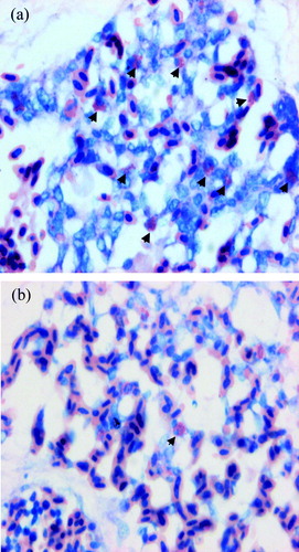 Figure 9.  Giemsa staining of the lung of (9a) an LPS-treated chicken and (9b) a control chicken. Black arrows indicate heterophils. Significantly more heterophils can be seen in LPS-treated chickens than in control chickens.