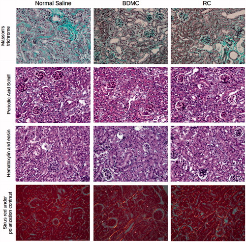 Figure 5. Histology of kidneys from mice which survived for 10 days after the rescue cell injection.Analysis shows similar tubular injury with some degree of regeneration and similar interstitial fibrosis.