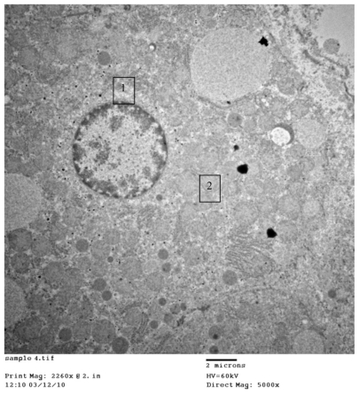 Figure 3B 1) Hepatocytes organelles (mitochondria) showing normal structure. 2) Regular distribution of cerium oxide nanoparticles with homogenous size all over the cytoplasm, original magnification ×5000.