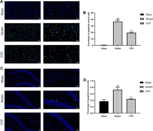 Figure 9 Pretreatment of NTF 7 days prior to CIRI reduced the neuronal apoptosis of the ischemic cortex and hippocampus in rats 24 h after reperfusion. (A) Representative images magnified 200 times and 400 times in ischemic cortex sections. (B) The apoptotic index indicates the percentage of TUNEL-positive cells in each group after 24 h of reperfusion in ischemic cortex. (C) Representative images magnified 200 times and 400 times in ischemic hippocampus sections. (D) The apoptotic index indicates the percentage of TUNEL-positive cells in each group after 24 h of reperfusion in ischemic hippocampus. All data were presented as mean ± SD. ##p<0.01 versus sham group; **p<0.01 versus model group, respectively.