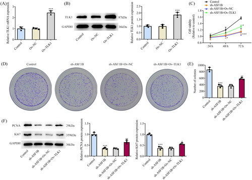 Figure 6. Upregulation of TLK1 partially reverses the effect of ASF1B interference on cell proliferation. (A and B) RT-qPCR and Western blot were used to detect the expression of TLK1 after transfection. ***p < 0.001 vs Ov-NC. (C) CCK-8 detected the cell viability. (D and E) Colony formation assay was used to detect the cell proliferation. F. Western blot was used to detect the expression of PCNA and Ki67. *p < 0.05, ***p < 0.001 vs Control; #p < 0.05, ##p < 0.01 vs sh-ASF1B + Ov-NC.