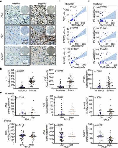 Figure 4. Immune marker expression in HNSCC. (a) Representative IHC staining of CD3, CD8 and FOXP3 in HNSCC specimens. Scale bar: 20 μm. (b) Paired t-test was used to compare the density of intratumoural CD3+, CD8+ and FOXP3+ cells in HNSCC. (c) Scatter plots with linear regression for intratumoural CD3, CD8 and FOXP3 levels using ANOVA test. (d) Scatter plots for intratumoural PD-L2 with CD3, CD8 and FOXP3 levels respectively using ANOVA test. (e) Relationship between CD3+, CD8+ and FOXP3+ TILs cell densities based on PD-L2 expression levels in tumor and stroma using the Kruskal–Wallis test