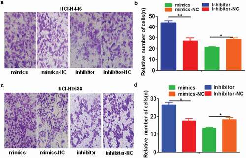 Figure 5. Effects of miR-485-5p and its inhibitor on the cell invasion ability in NCI-H446 and NCI-H1688 cells. Cell invasion ability of NCI-H446 and NCI-H1688 cells was determined by Transwell matrigel invasion assay. The number of cells invaded into the matrigel were quantified and expressed as mean ± SEM from three independent experiments. (a), Transwell matrigel invasion assay of NCI-H446 cells; NCI-H446 cells were transfected with miR-485-5p mimics, miR-485-5p inhibitor or their corresponding controls (mimics-NC, inhibitor-NC), respectively; (b), comparison of the number of invaded cells among the NCI-H446 cells transfected with miR-485-5p mimics, miR-485-5p inhibitor or their corresponding controls; (c), Transwell matrigel invasion assay of NCI-H1688 cells; NCI-H1688 cells were transfected with miR-485-5p mimics, miR-485-5p inhibitor or their corresponding controls (mimics-NC, inhibitor-NC), respectively; (d), comparison of the number of invaded cells among the NCI-H1688 cells transfected with miR-485-5p mimics, miR-485-5p inhibitor or their corresponding controls (n=3, *p<0.05, **p<0.01).