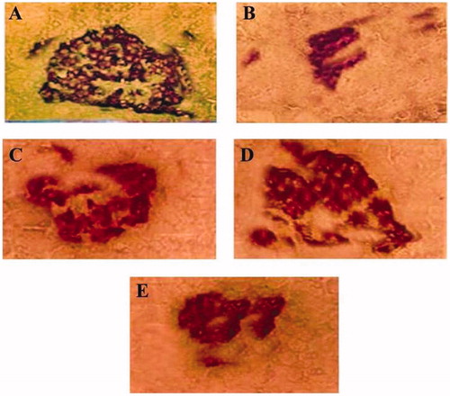 Figure 5. Light photo micrographs of rat pancreas showing insulin-immunoreative expression of β-cells in islet of Langerhans. (A) Islet of normal control rat. (B) Islet of diabetic control rat. (C and D) Islet of F. carica-treated (250 and 500 mg/kg) diabetic rats. (E) Islet of glibenclamide-treated (0.6 mg/kg) diabetic rats.