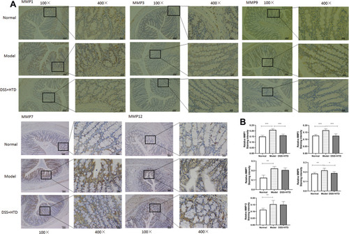 Figure 9 Representative immunohistochemical staining with MMP1, MMP3, MMP7, MMP9 and MMP12 in colon tissues in mice treated with DSS. (A) Immunohistochemical staining for MMP1, MMP3, MMP7, MMP9 and MMP12 in normal, model and DSS+HTD group. (B) Statistical analysis of relative immunohistochemical staining intensity for MMP1, MMP3, MMP7, MMP9 and MMP12 in normal, model and DSS+HTD group.*P < 0.05, **P < 0.01 and ***P < 0.001 versus model group.