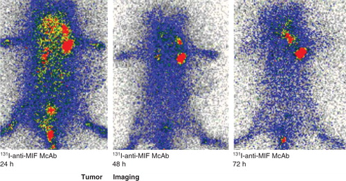 Figure 2. Images of the hepatocellular carcinoma (HCC) mice model. The 131I-anti-MIF McAb group had clear images in accordance with the high T/NT ratio.