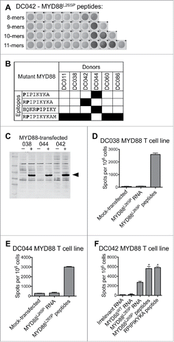 Figure 1. T cells from healthy donors recognize MYD88L265P peptides and full-length MYD88L265P. Healthy donor T cell lines derived from in vitro stimulation with the MYD88L265P peptide library were screened by IFNγ ELISPOT for reactivity against each individual peptide and against B cells expressing full-length MYD88L265P. (A, B) T cell lines were stimulated with each of the 38 peptides in the MYD88L265P library (1 peptide/well). The minimal peptide was defined as the shortest peptide with the strongest response of all peptides tested. (A) ELISPOT wells from one DC042 T cell line showing reactivity to eight closely related peptides derived from MYD88L265P. (B) Summary of minimal epitopes recognized by T cells. The minimal epitope was defined as the shortest peptide with the strongest response of all peptides tested. Mutant residues are indicated in bold font. (C–F) Autologous CD40-activated B cells were transfected with ivtRNA encoding full-length MYD88L265P and used to stimulate T cell lines. (C) Western blot demonstrating expression of MYD88 by transfected B cells. (D–F) ELISPOT results for T cells (1–1.5 × 105 cells/well) incubated with B cells (2 × 105/well) that had been pulsed with peptides or transfected with ivtRNA. T cell lines from (D) DC038 and (E) DC044 did not recognize processed MYD88L265P, but a T cell line from (F) DC042 did recognize processed MYD88L265P. Asterisks refer to conditions that were too numerous to count (TNTC).