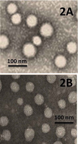 Figure 2. TEM micrographs of SLN-NAC.