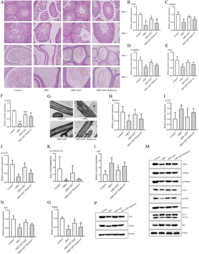 Figure 5. QJT increased mitophagy and mitochondrial ubiquitination by LKB1/AMPK signaling pathway in ORN-treated rats. (A) Testis (upper) and epididymis (down) tissues were assessed by H&E staining. (B–D) Relative protein levels of LKB1 (B), AMPKα (C), p-AMPKα (D), ULK1 (E), and p-ULK1 (F) were examined by western blotting. (G) Mitochondria were evaluated by TEM. (H–P) Relative protein levels of Beclin-1 (H), LC3 (I–K), p62 (L), SCF (N), and Parkin (O) were detected by western blotting. Data were expressed after being normalized to β-actin. *p < 0.05 vs. Control group; #p < 0.05 vs. ORN group; &p < 0.05 vs. ORN + QJT group. All assays were performed five times.