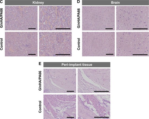 Figure 6 Gross histological analysis of liver (A), spleen (B), kidney (C), brain (D), and peri-implant tissue (E) 120 days after operation (scale bar =200 μm, magnification 100×).Abbreviation: G/nHA/PA66, graphene/nanohydroxyapatite/polyamide66.