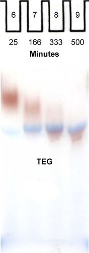 Figure S1 Gel of splenectomized animal plasma 25, 166, 333, and 500 minutes following injection of TEG particles.Abbreviation: TEG, tetraethylene glycol.