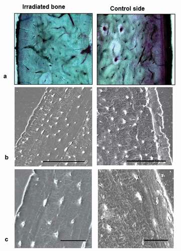 Figure 4. Scanning electron microscopy and bright field microscopy of alveolar bone (basic fuchsin). A) On the control side, the vitality of the alveolar bone beneath the periosteum is better than on the irradiated side. B and C) Osteocytes with few dendrites are located beneath the periosteum in the irradiated bone, whereas in control side, osteocytes with numerous dendrites are visible. (Bars = 100 µm)