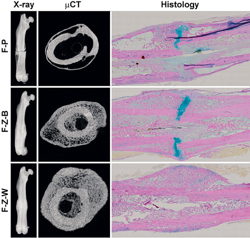 Figure 1. Fracture healing. Representative images of fracture healing at 8-week endpoint presented as digital radiography (left panels), μCT section (center panels), and histological section (Weigert’s hematoxylin, Alcian blue, and van Gieson) (right panels) of rats treated with placebo (upper row), bolus ZA (middle row), and ZA on a weekly basis (bottom row).
