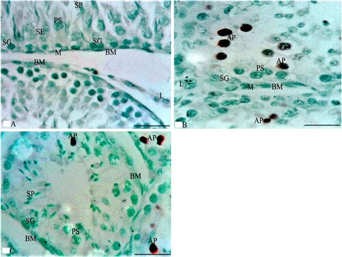Figure 6. Photomicrographs from rabbit testes that were immunostained by TUNEL assay. A section from G1 in Figure 6A shows the boundaries of two ST that are separated by a thin LCT with multiple L cells between the ST. The ST rest on the BM and are lined by SE and spermatogenic cells, such as SG, PS, and SP that do not reveal apoptosis. Additionally, a section from G2 in Figure 6B shows the boundaries of two adjacent ST that are separated by a few L cells between the ST. The ST are lined by spermatogenic cells, such as SG (that rest on BM with M cells) and PS that reveal multiple apoptotic cells (AP). Meanwhile, the section of G3 in Figure 6C reveals the boundaries of four ST that are separated by a thin LCT. The ST rest on BM and are lined by spermatogenic cells such as SG, PS, and SP that reveal few AP cells. TUNEL assay × 1000 and the bar = 50 μm.