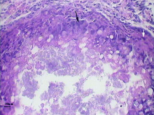 Figure 3.  Typical granulomatous lesion in the liver of an affected bird. Note the centre of the lesion surrounded by foamy macrophages (white arrow), and multinucleated giant cells (black arrow). Haematoxylin and eosin staining.