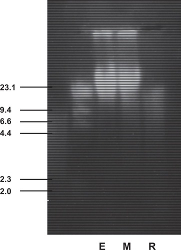 Figure 3 Ethidium bromide-stained agarose gel (1%) showing electrophoretic mobility of 10 μg genomic DNA, which had been freshly isolated from GH3 cells treated with 100 μM resveratrol (R) for 48 hours, or with the corresponding concentration of 0.1% of the solvent ethanol (E) or solely with cell-culture medium (M). λ-DNA digested with the restriction endonuclease Hind-III served as a molecular weight standard ranging from 2 to 23.1 kb. It can be seen that the DNA isolated from the medium or solvent controls migrates as a bright spot of high-molecular-weight genomic DNA of approximately 20 kb, while this spot disappeared in resveratrol-treated cells and was replaced by a more continuous faint staining along the whole lane, thus indicating severe DNA degradation. The continuous staining of this lane was clearly visible under the ultraviolet illumination. It cannot be seen ideally on the photograph, due to the large differences in fluorescence/cm2 compared to the high-molecular-weight DNA in lanes E and M. Four independent observers confirmed this homogeneous stain, but did not detect any laddering. This result indicated that most of the cells had died by a nonapoptotic mode of cell death.