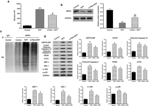 Figure 5. 4-PBA protected mice against RFP-induced cholestatic liver injury.