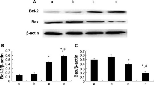 Figure 6 Myocardial Bcl-2 and Bax expression. (A) Bcl-2 and Bax protein expressions detected by Western blotting; (B) Relative protein expression level of Bcl-2; (C) Relative protein expression level of Bax; (a) control group; (b) 1 μM picroside II pretreatment group; (c) 10 μM picroside II pretreatment group; and (d) 100 μM picroside II pretreatment group.