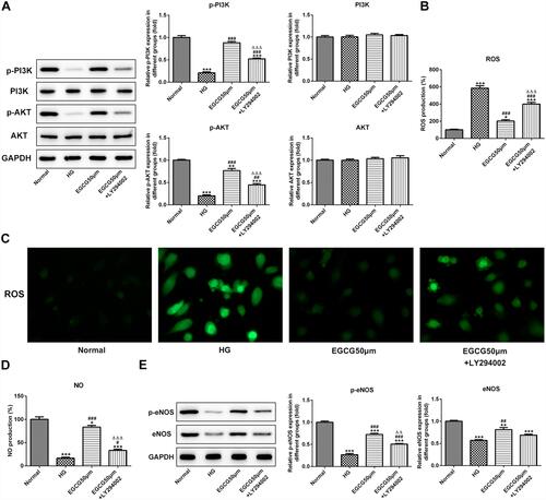 Figure 6 EGCG alleviates endothelial dysfunction of hyperglycemia-induced vascular endothelial cells by activating the PI3K/AKT pathway. (A) The expression of P-PI3K, P-AKT, PI3K and AKT in HG-treated HUVECs affected by EGCG and LY294002 was determined by Western blot analysis. **P<0.01 and ***P<0.001 vs Normal group. ##P<0.01 and ###P<0.001 vs HG group. ∆∆∆P<0.001 vs EGCG50μM group. (B) The ROS levels in HG-treated HUVECs affected by EGCG and LY294002 was detected by ROS ELISA assay. *P<0.05 and ***P<0.001 vs Normal group. ###P<0.001 vs HG group. ∆∆∆P<0.001 vs EGCG50μM group. (C) The ROS levels in HG-treated HUVECs affected by EGCG and LY294002 was detected by fluorometric ROS assay. (D) The NO levels in HG-treated HUVECs affected by EGCG and LY294002 was analyzed by ROS ELISA assay. *P<0.05 and ***P<0.001 vs Normal group. #P<0.05 and ###P<0.001 vs HG group. ∆∆∆P<0.001 vs EGCG50μM group. (E) The expression of p-eNOS and eNOS in HG-treated HUVECs affected by EGCG and LY294002 was determined by Western blot analysis. **P<0.01 and ***P<0.001 vs Normal group. ##P<0.01 and ###P<0.001 vs HG group. ∆∆P<0.01 vs EGCG50μM group.