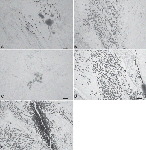 Figure 4. Transmission electron microscopic images of (A) trypsin, (B) osmotic, (C) trypsin-osmotic, (D) detergent-osmotic decellularized, and (E) control leaflets. (A) shows some remnants of GAGs. In osmotic matrices (B) GAGs are well preserved and closely associated with collagen fibres compared to controls (E). Detergent-osmotic matrices (D) show GAG preservation, but less association with collagen fibres. A complete loss of GAGs is present in trypsin-osmotic leaflets (C). Scale bar 500nm.