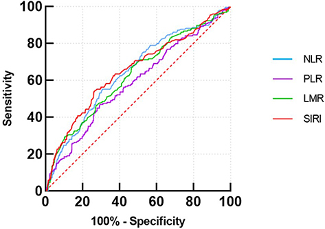 Figure 2 Receiver operating characteristic curve of inflammatory composite indicators. The AUC was 0.644 (0.599–0.688) in blue line for NLR, 0.587 (0.540–0.633) in purple line for PLR, 0.628 (0.582–0.674) in green line for LMR, 0.651 (0.605–0.697) in red line for SIRI.